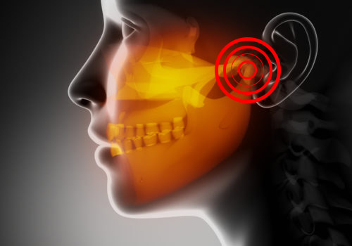 Maxillofacial concept  x-ray jaws